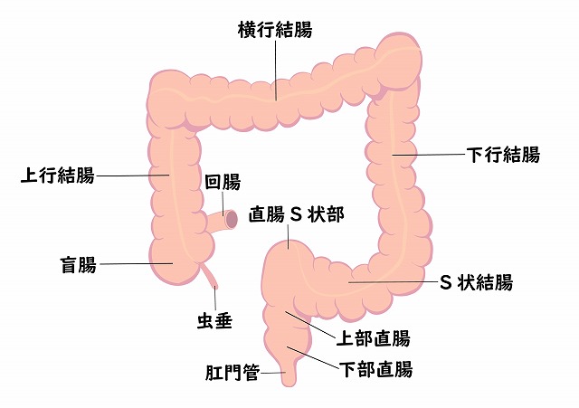 大腸がん